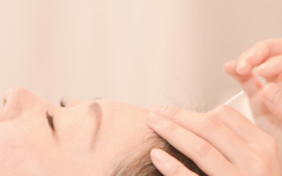 【名古屋 伏見】ヘッドスパ×鍼灸｜脳疲労とストレスをリセット