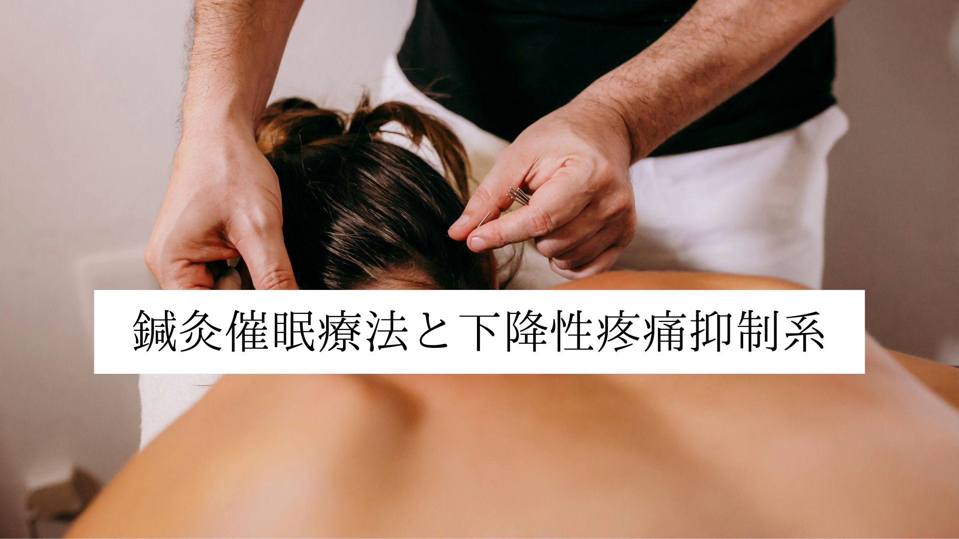 鍼灸催眠療法と下降性疼痛抑制系