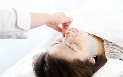 Facial Acupuncture in Nagoya | Natural Beauty & Relaxation at Yurumari