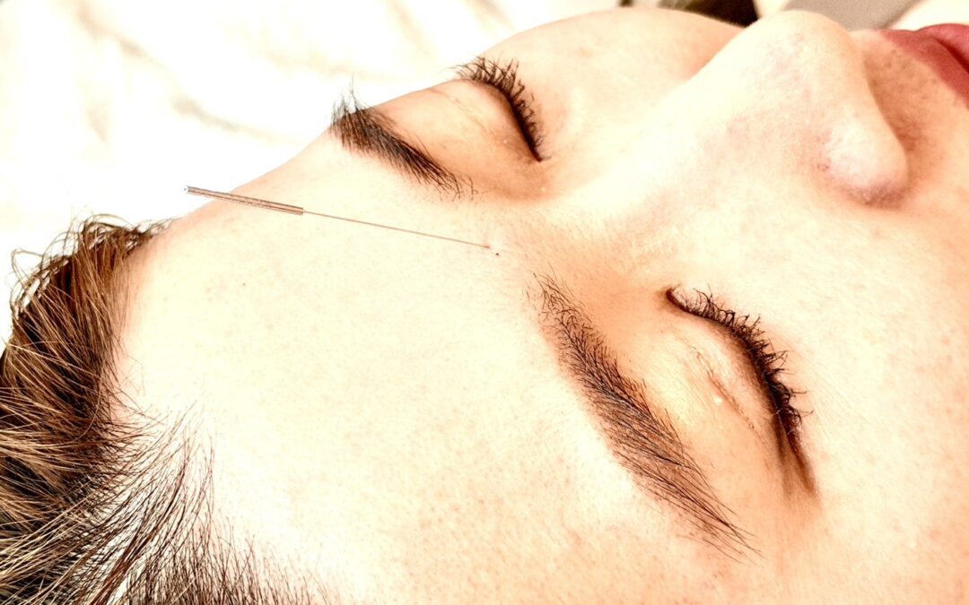【名古屋 伏見】脳疲労 鍼灸｜スマホ疲れ・考えすぎ・眠れない頭を深くリセット