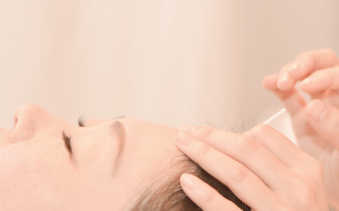 Skin Dryness Acupuncture in Nagoya Fushimi | Yurumari