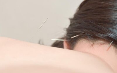 デスクワークが原因の腰痛を改善する方法とは？伏見の鍼灸院の施術例