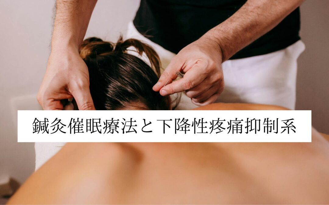 鍼灸催眠療法と下降性疼痛抑制系｜名古屋・伏見 鍼灸院